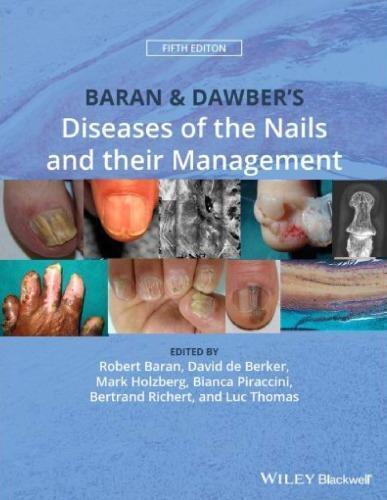 Baran Dawbers Diseases Of The Nails And Their Management 5Th