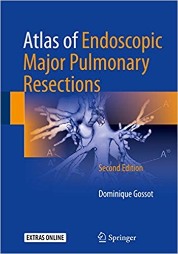 Atlas of Endoscopic Major Pulmonary Resections 2nd