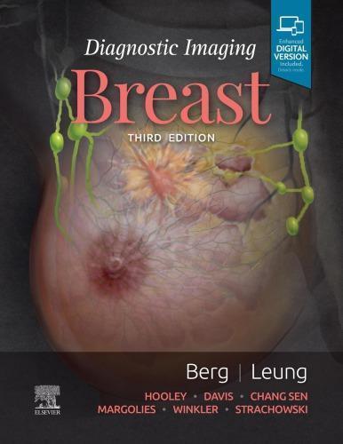 Diagnostic Imaging Breast 3Rd
