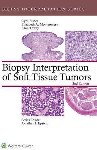 Biopsy Interpretation Of Soft Tissue Tumors 2Nd