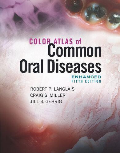 Color Atlas Of Common Oral Diseases Enhanced 5Th
