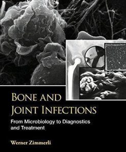 Bone And Joint Infections From Microbiology To Diagnostics And Treatment