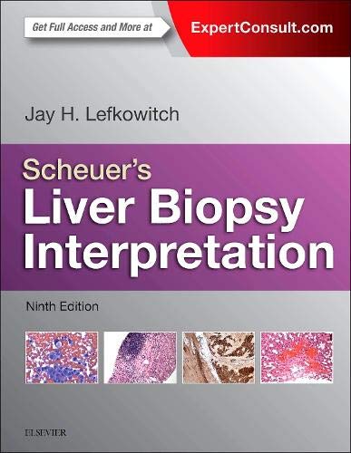 Scheuers Liver Biopsy Interpretation 9e 8211 9th