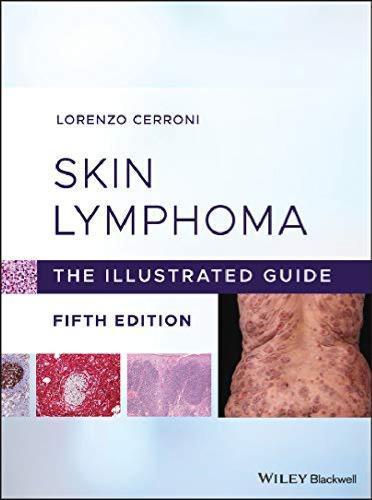 Skin Lymphoma The Illustrated Guide 5Th