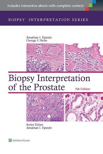 Biopsy Interpretation of the Prostate 8211 5th