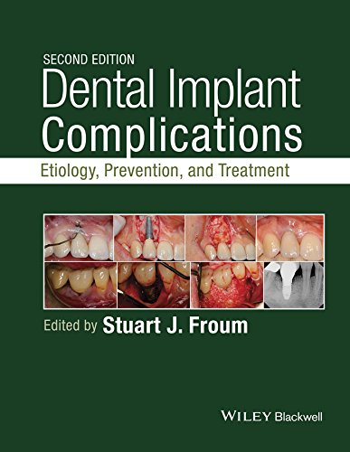 Dental Implant Complications Etiology Prevention and Treatment 2nd