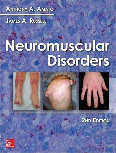 Neuromuscular Disorders 2Nd Amato