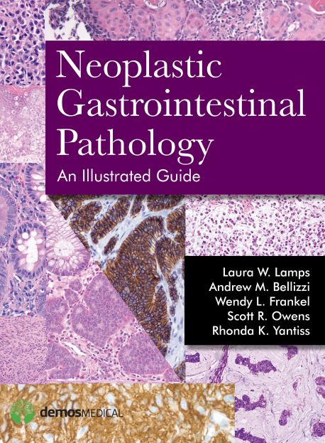 Neoplastic Gastrointestinal Pathology 1st 1E Laura Lamps
